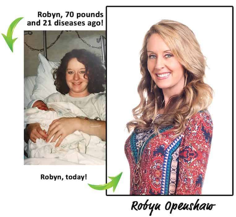 Robyn, 70 pounds and 21 diseases ago! Robyn today!