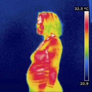 Image of Thermography on pregnant woman from "6 Things Every Woman Should Know About Breast Cancer" By Green Smoothie Girl
