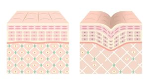 Graphic of skin layers from "Bone Broth Protein: Why You Should Try It" by Green Smoothie Girl