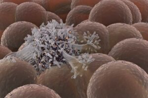 a cancer cell is spreading among healthy cells