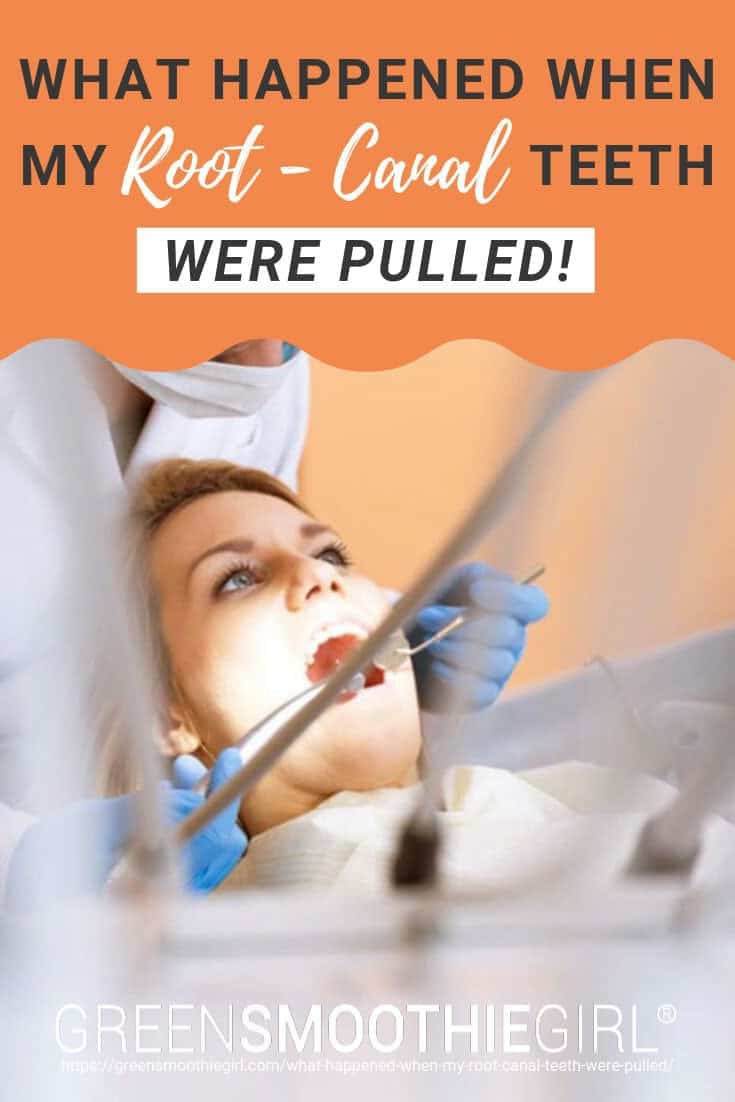 Photo of woman with mouth open and dentist with surgical tools with post's text from "What Happened When My Root-Canal Teeth Were Pulled" by Green Smoothie Girl