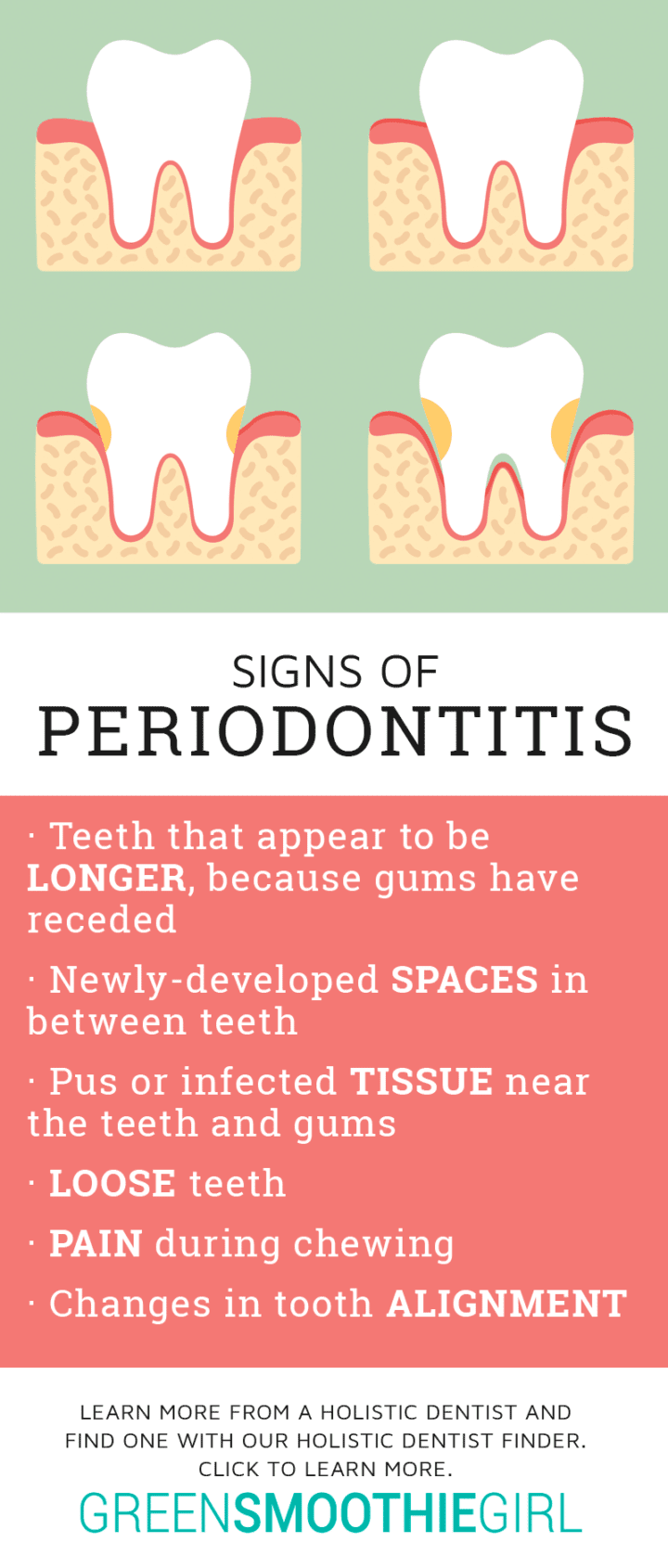 Periodontitis vs Gingivitis Know the Differences & Warning Signs