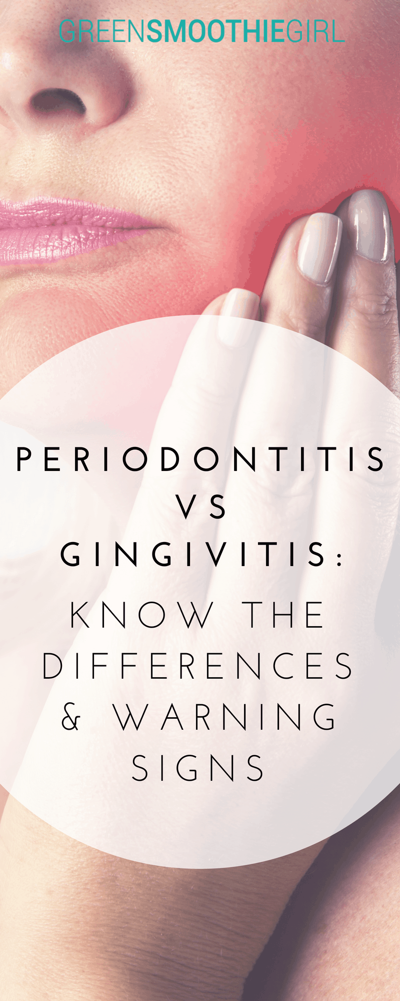 Periodontitis vs Gingivitis Know the Differences & Warning Signs