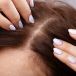 Why Does Everyone Have Thinning Hair?