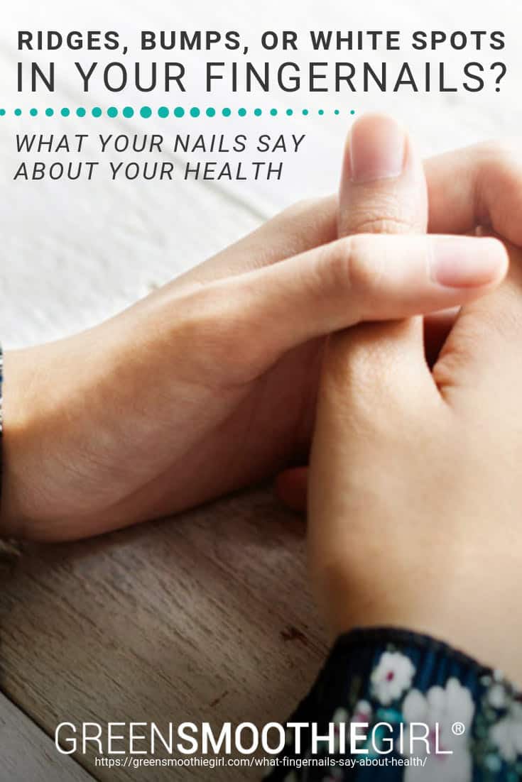 Ridges, Bumps, Or White Spots In Your Fingernails? What Your Nails Say About Your Health