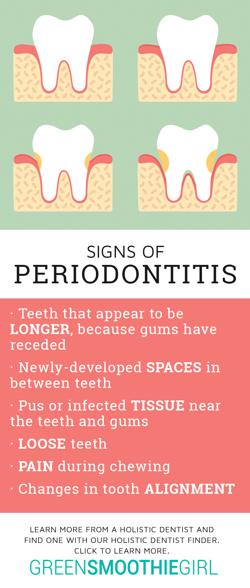 Periodontitis vs Gingivitis: Know the Differences & Warning Signs