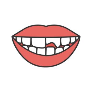 Illustration of broken or chipped tooth in a smile from "Teeth Hurt? When To See A Dentist, Or Use Home Remedies" by Green Smoothie Girl