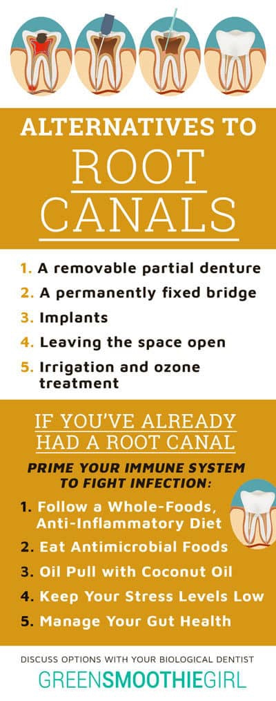 If You Re Looking For Alternatives To Root Canal Start Here   Root Canal Infographic WEB 