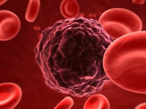 3-rendition cancer and blood cells from "3-Day Water Fasting vs. 3-Day Modified Fasting" by Green Smoothie Girl