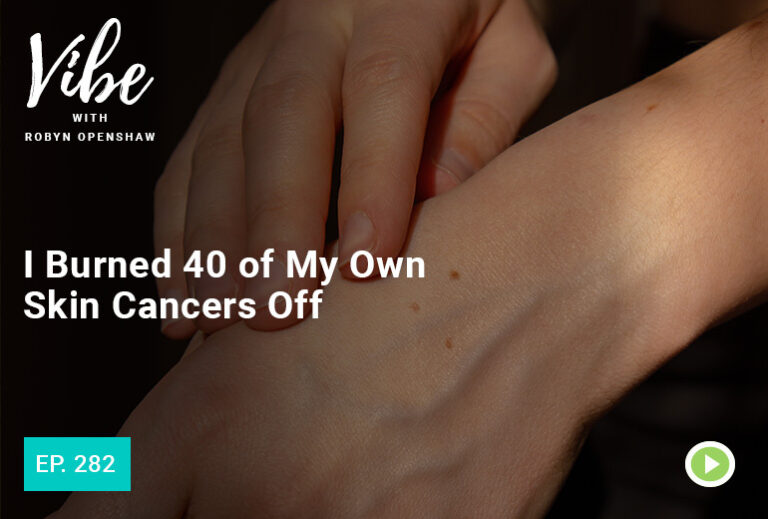 Vibe with Robyn Openshaw: I burned 40 of my own skin cancers off